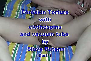 Foreskin vacuum task for accompanying Ratenn Part1