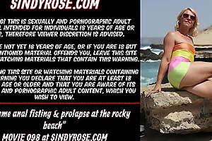 Extreme anal fisting and prolapse elbow the rocky beach Sindy Rose
